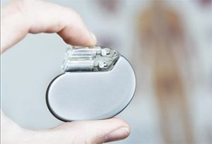 Imatge d'un marcapassos